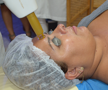 tratamento a lase para rejuvenescer a pele do rosto